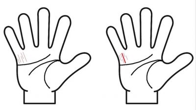 金運線がたくさん