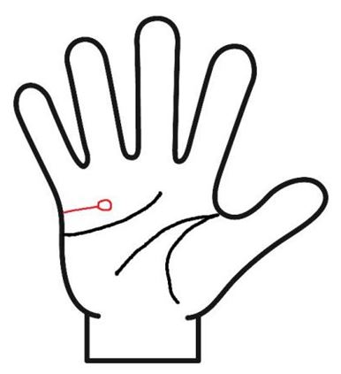 結婚線の先端に島