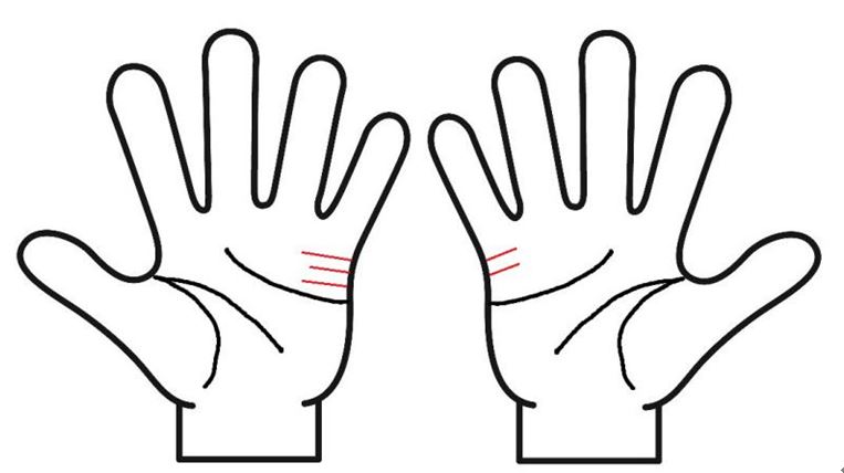 結婚線右手左手