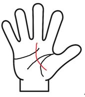 運命線が曲がる