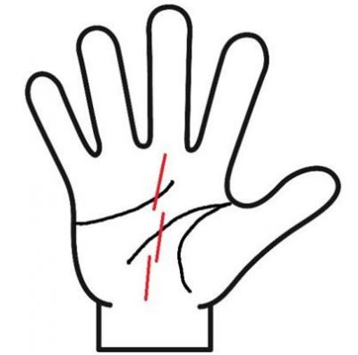 運命線が切れてる