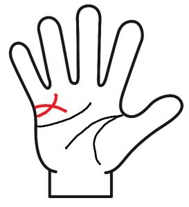 ２本の結婚線が交差