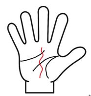 運命線がうねうね