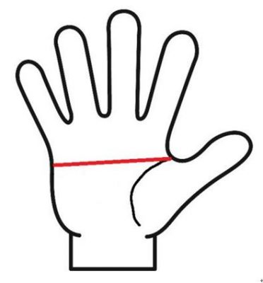 マスカケ線とは