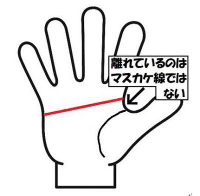 マスカケ線が下がっている