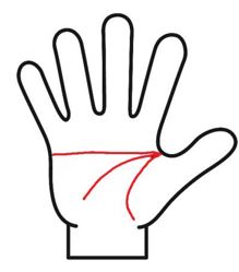 感情線、頭脳線、生命線が１点に集まるマスカケ線