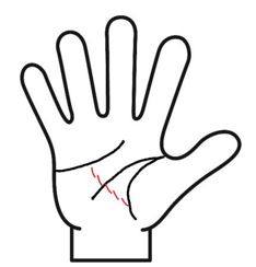 健康線が細かく切れ切れ