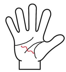 健康線がう曲がっている