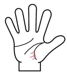 慢性的な疲労とストレス