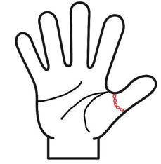 親指の付け根の線がリング状