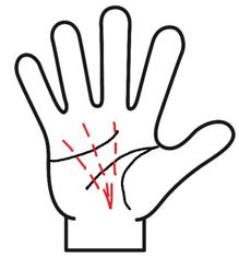 覇王線が切れ切れ