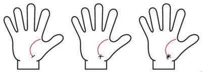 生命線の先端が障害線・十字・星