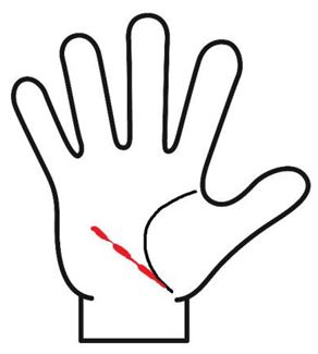 健康線の幅が広くなったり細くなっている