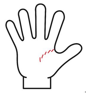 生命線が短い線で切れ切れになっている