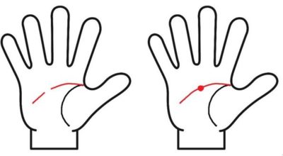 頭脳線の切れ目や赤い斑点