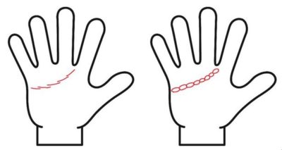 感情線が切れ切れ・鎖状