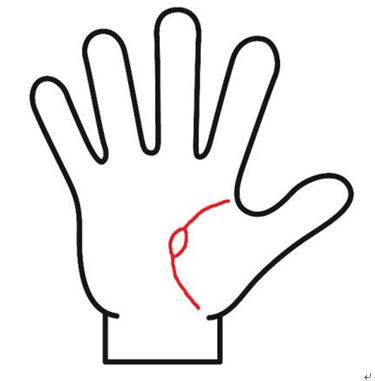 手相の斑点は怪我