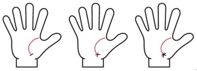 生命線の先端に障害線、十字、星