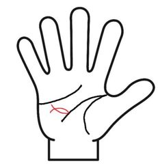 フィッシュ線が大きい