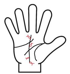 運命線にフィッシュ線がある