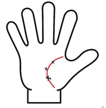 生命線が切れている