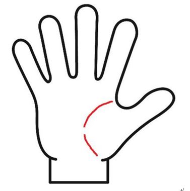 生命線が切れている