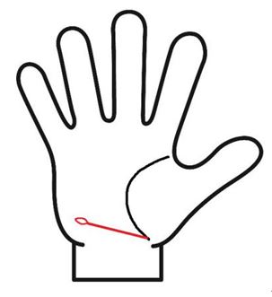 手のひらの左下にある健康線に島