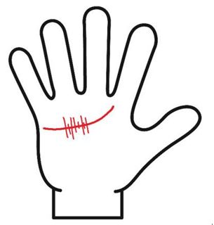 感情線上に短く細かい縦線